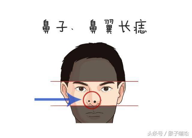 痣长在什么地方最好运势痣的位置与运势，痣长在什么地方最能带来好运？
